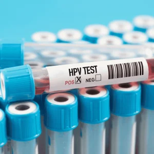 HPV Pozitif Çıktı, Ne Yapmalıyım