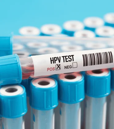 HPV Pozitif Çıktı, Ne Yapmalıyım