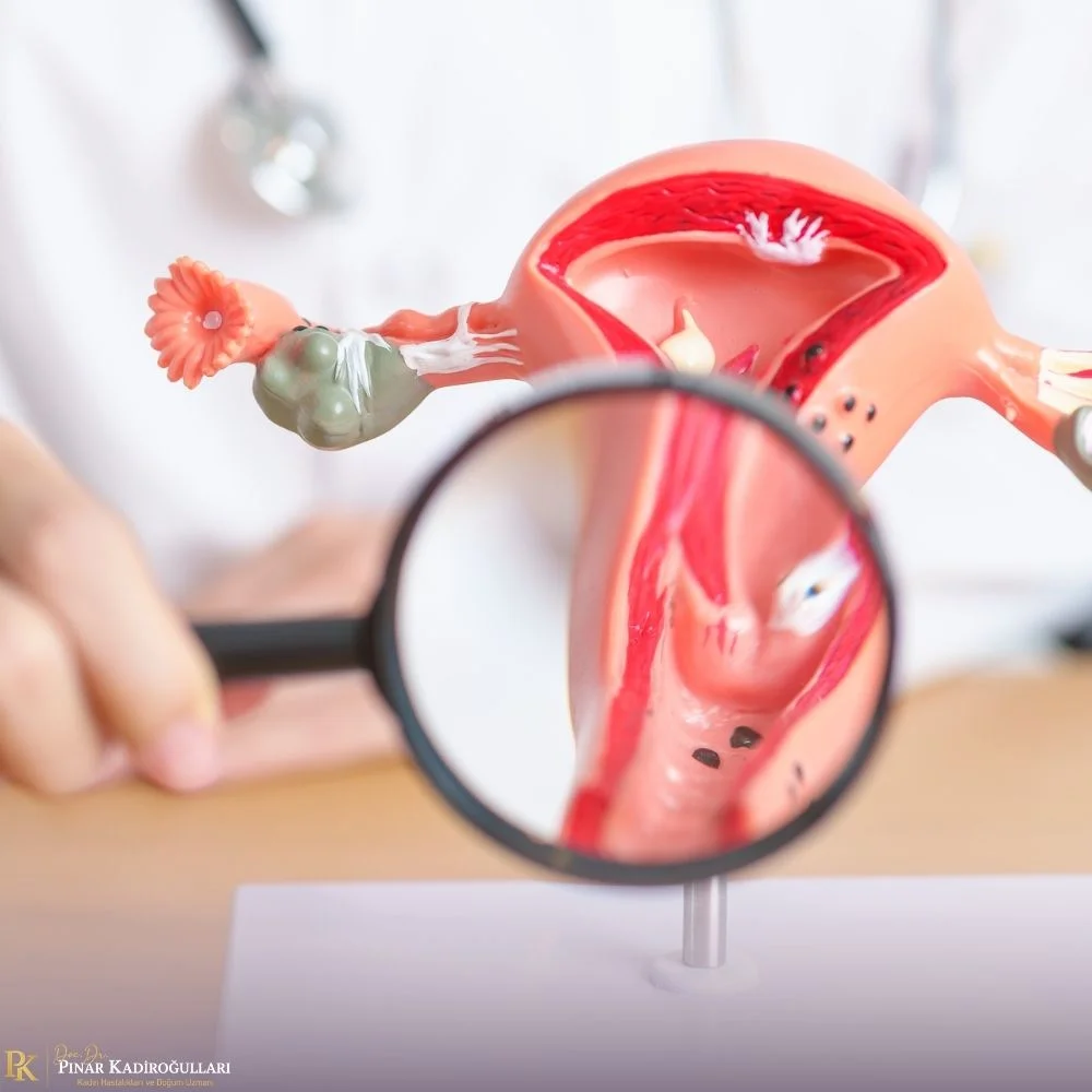 Myomectomy fibroid surgery Istanbul Nişantaşı