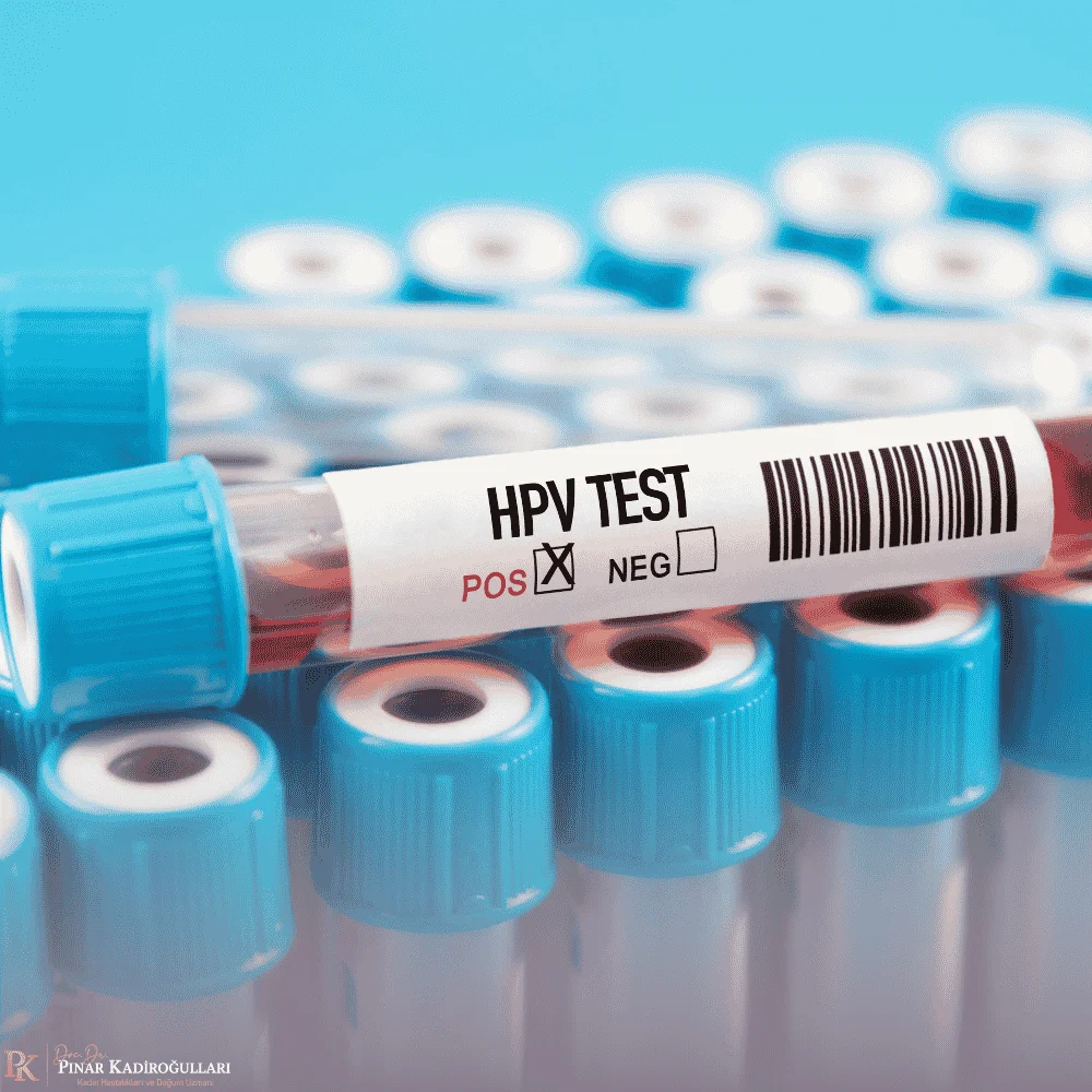 HPV pozitif çıktıktan sonra ne yapılmalı