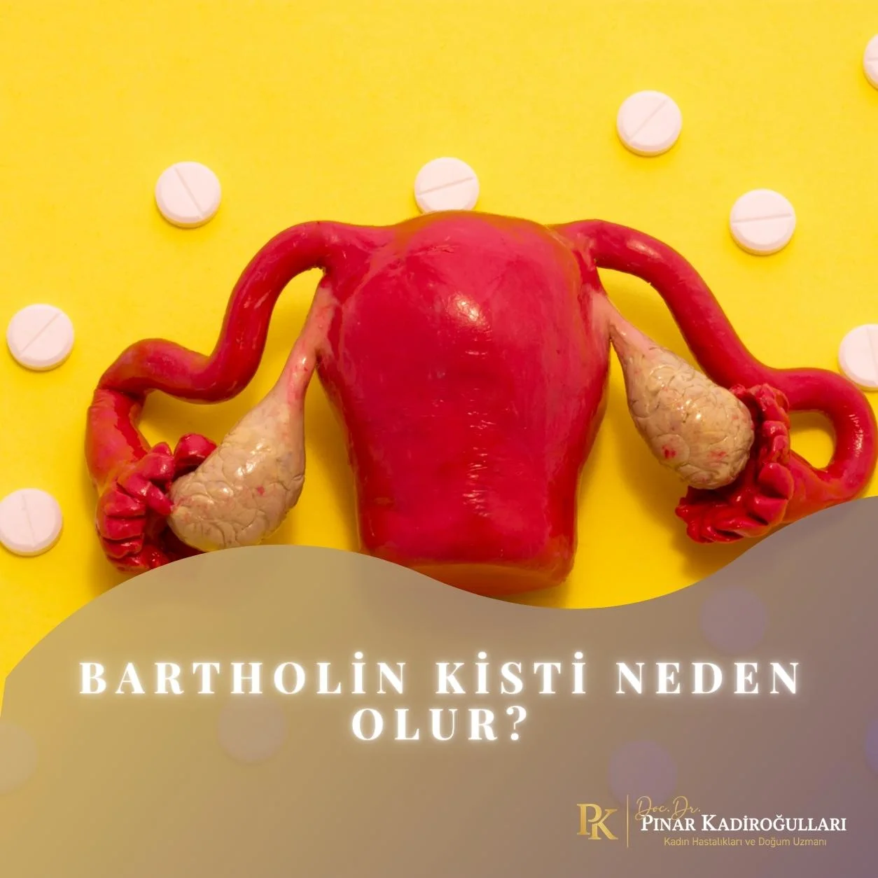 Bartholin kisti neden olur?