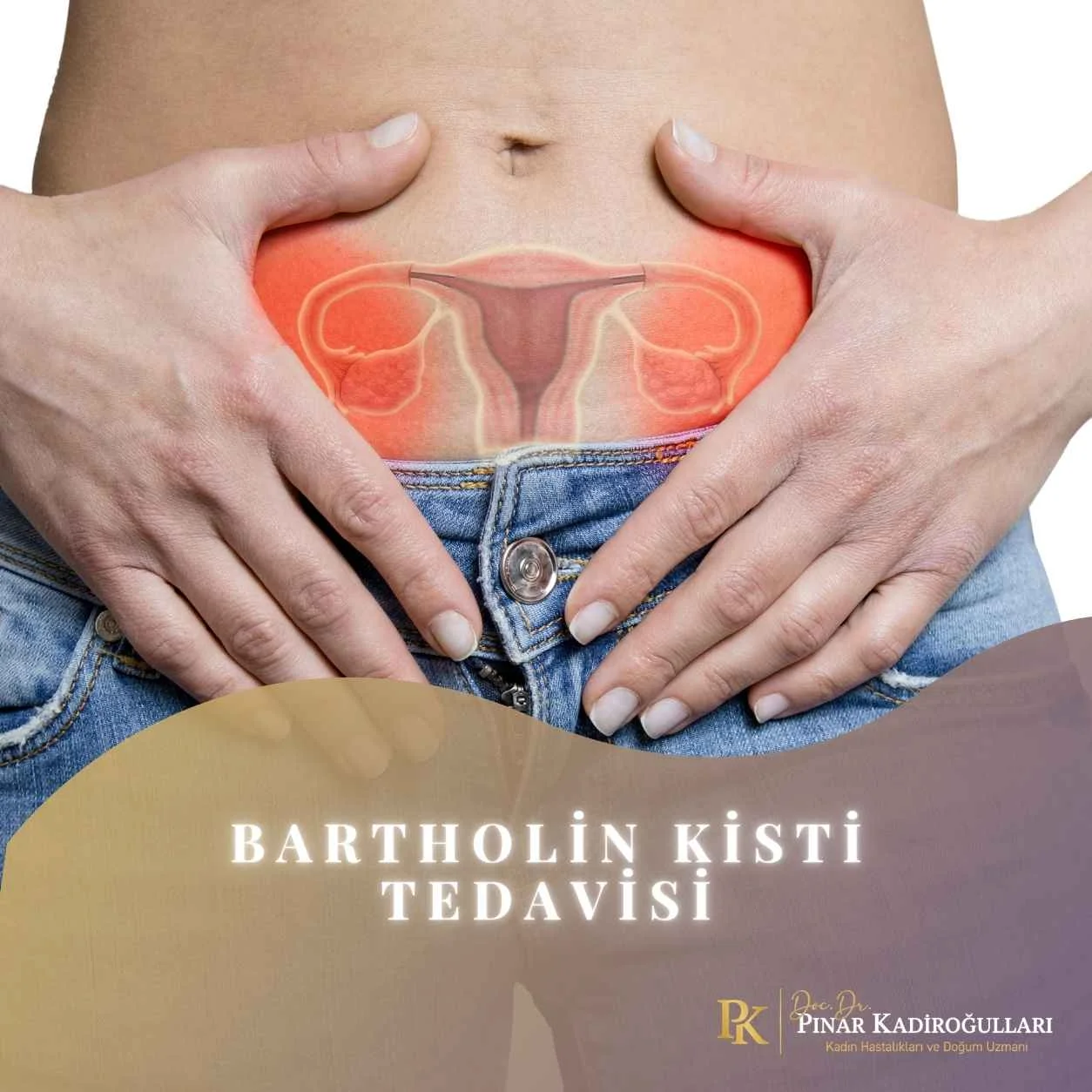 Bartholin Kisti ameliyatı