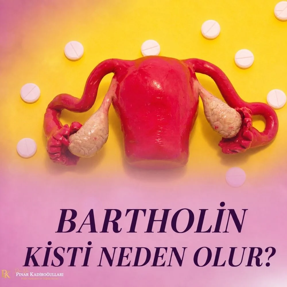 Bartholin kisti neden olur?